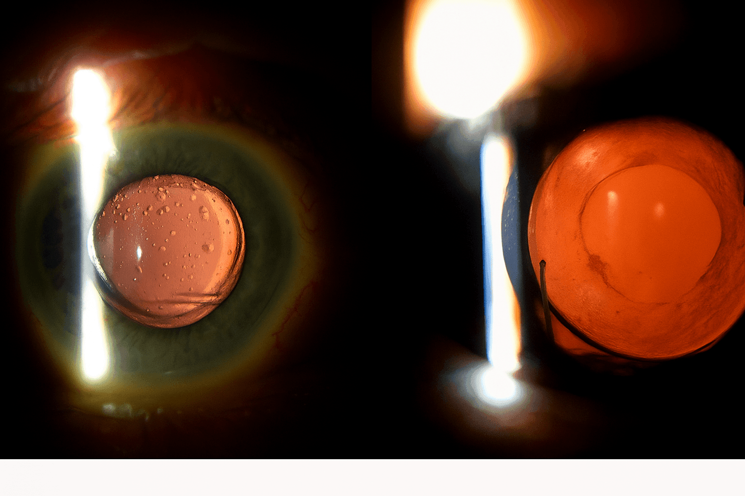 Click a second image, a side by side comparison is generated